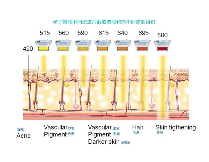 五大光子嫩膚技術(shù)（IPL、DPL、OPT、APT、BBL）及濾光片區(qū)別